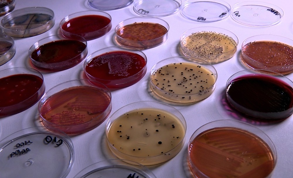 Estudo identifica 23 mil fungos e bactérias em celulares; risco vai de micoses até infecções respiratórias